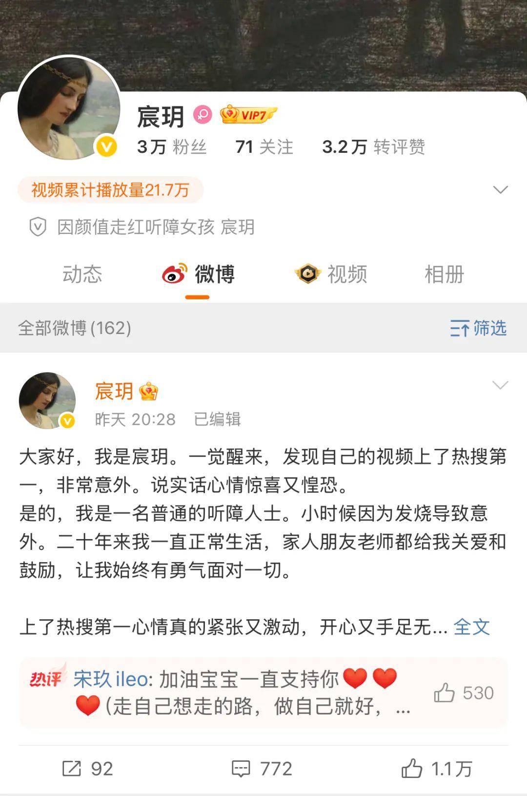 皇冠信用網申请条件_听障女生因“长相完美”走红皇冠信用網申请条件，背后MCN机构曝光