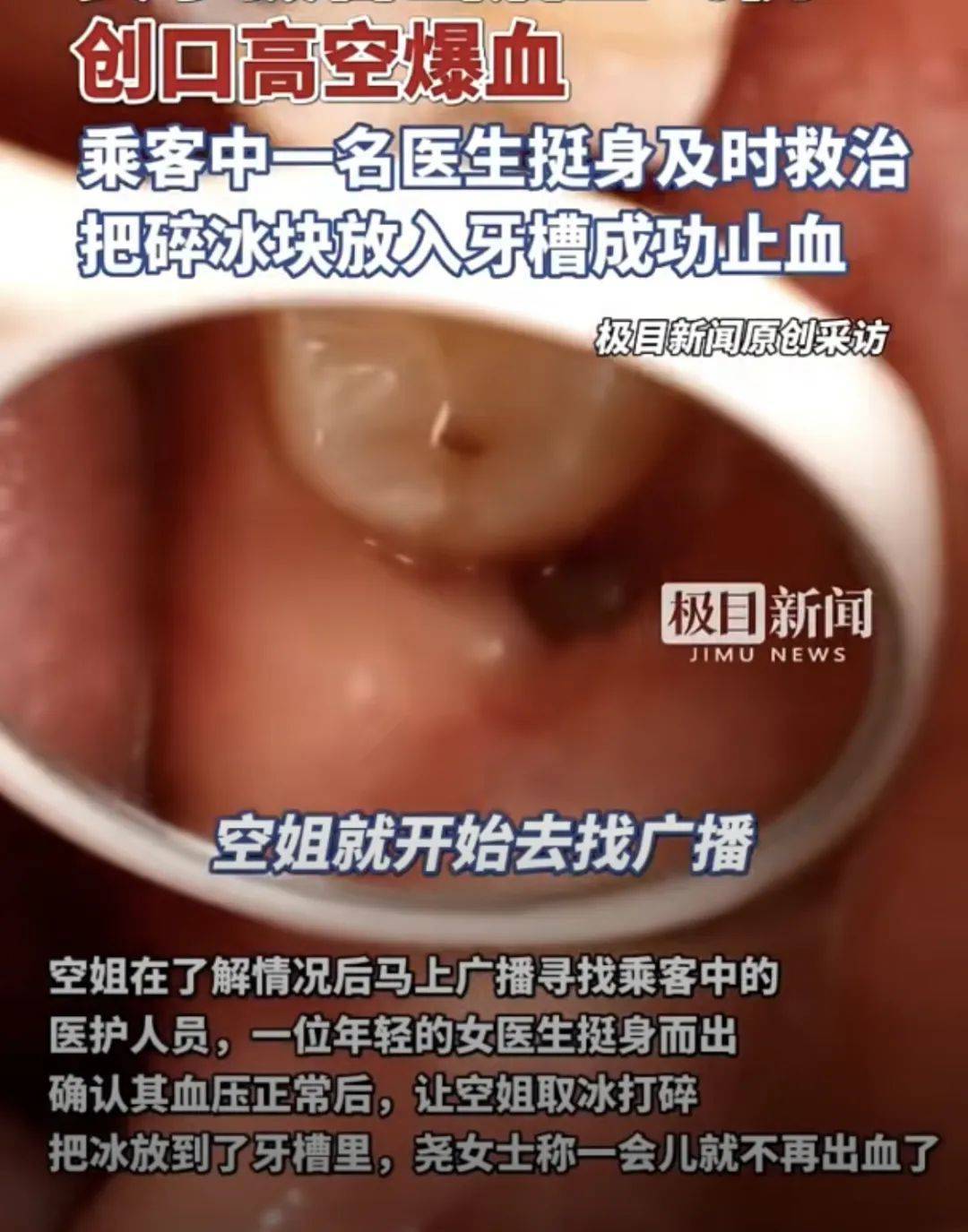 皇冠信用盘庄家_高空惊魂皇冠信用盘庄家！女子拔智齿后坐飞机嘴里突然开始冒鲜血……医生紧急提醒
