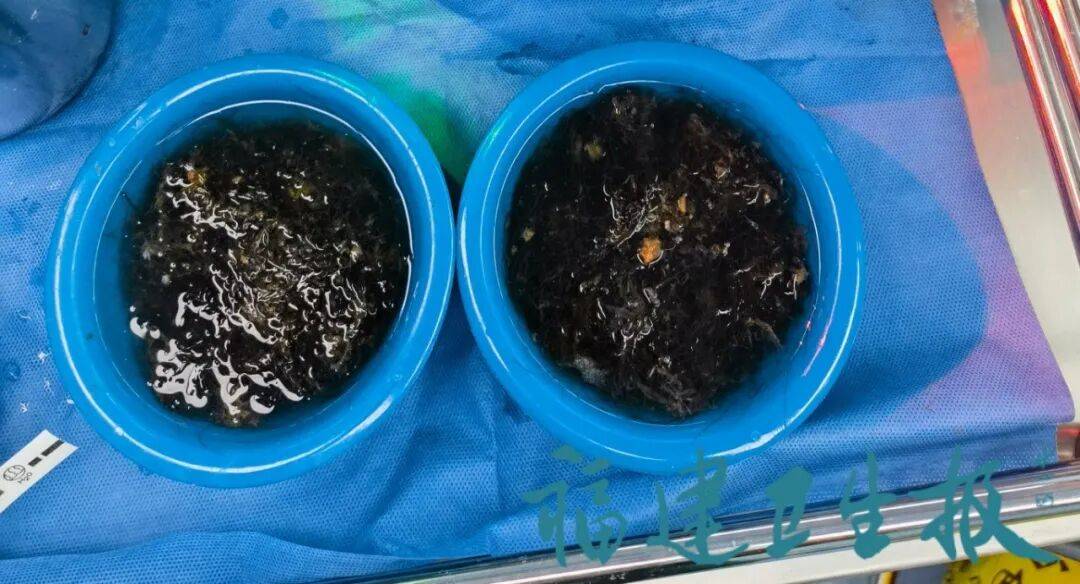 皇冠信用网账号申请_发现一例皇冠信用网账号申请，10岁女孩确诊！已有多起病例，有人因羞耻感延误就医